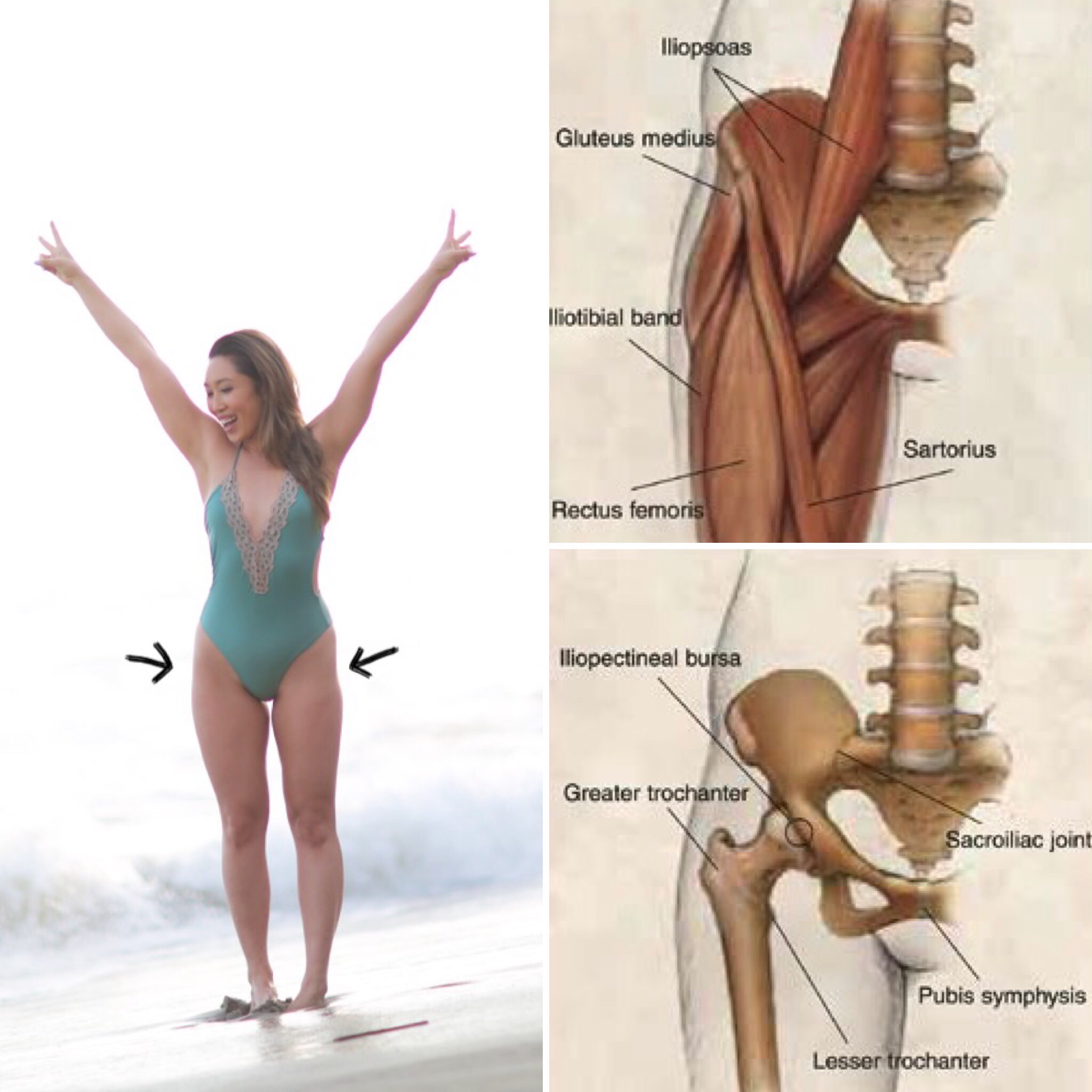 the anatomy of hip dips and picture of cassey ho showing where hip dips occur